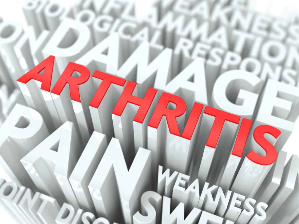 Arthritis and the myths